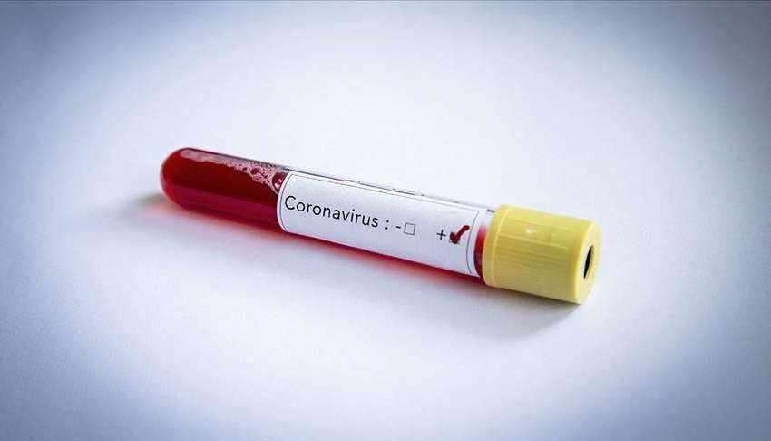 cote-divoire-coronavirus-les-details-sur-livoirien-contamine