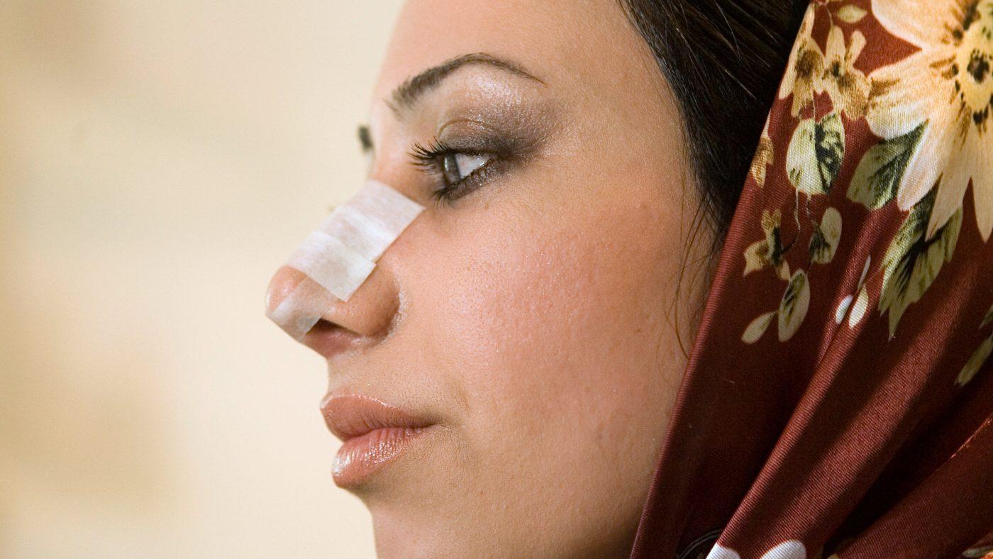 Insolite : Iran, le pays de la chirurgie esthétique