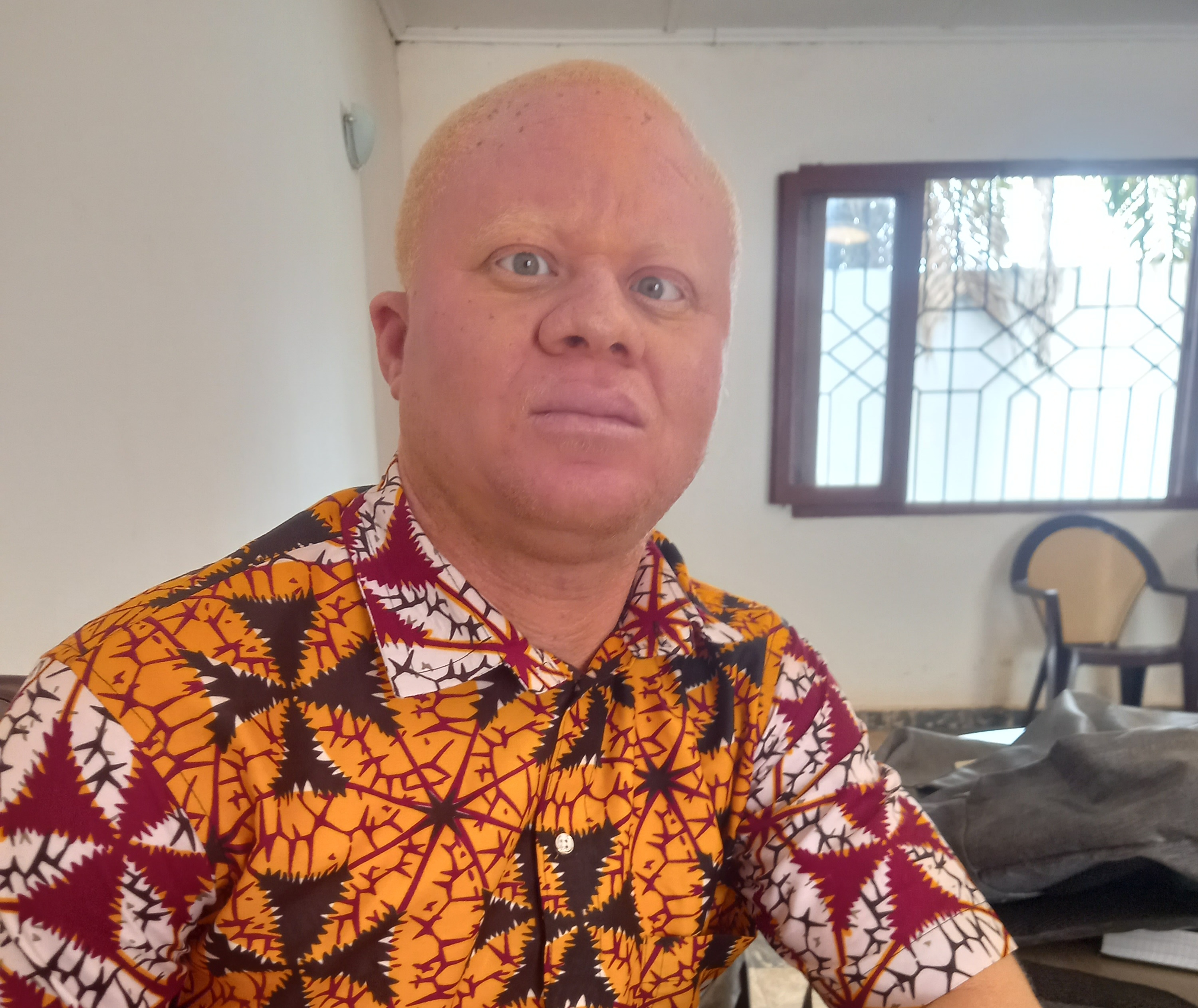 region-du-goh-les-albinos-se-disent-laisses-pour-compte